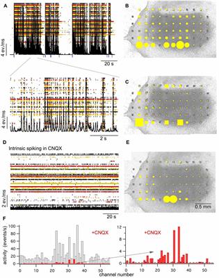 Critical Components for Spontaneous Activity and Rhythm Generation in Spinal Cord Circuits in Culture